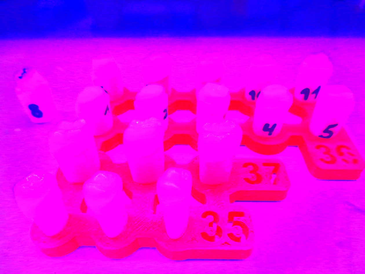 Neon-Zähne von Martina Konitzky