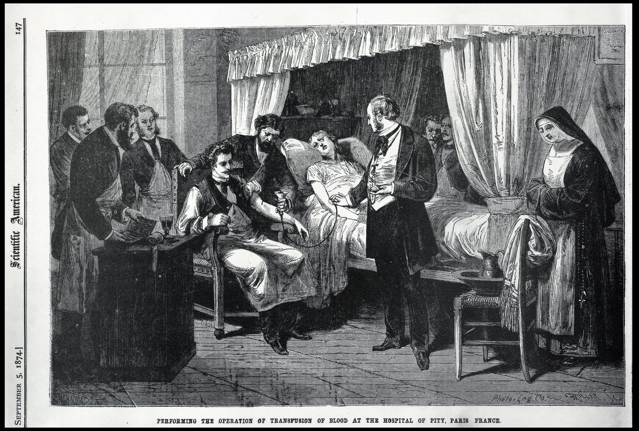 Durchführung der Bluttransfusion im Krankenhaus der Barmherzigkeit, Paris, Frankreich, Illustration aus dem American Scientist von American School