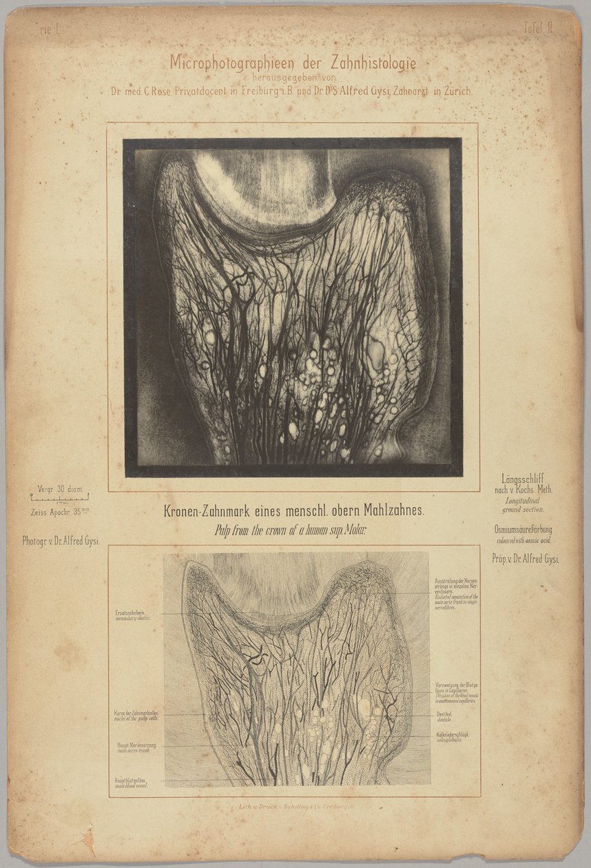 Pulpa aus der Krone eines menschlichen oberen Molaren von Dr. Alfred Gysi