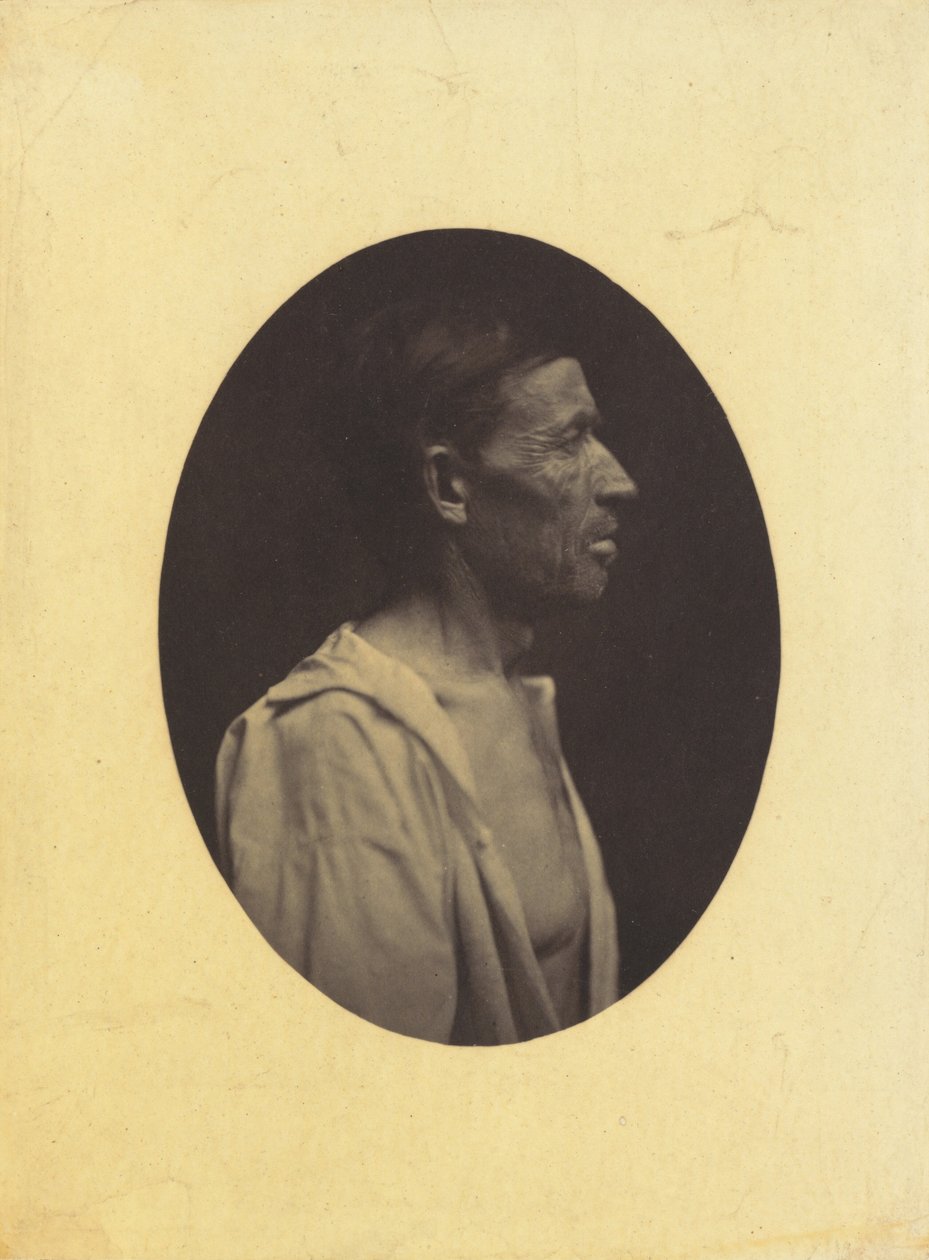 Ein Porträt, im Profil gesehen, eines 42-jährigen Mannes, betäubt durch Alkoholmissbrauch..., 1854-1856 von Duchenne de Boulogne