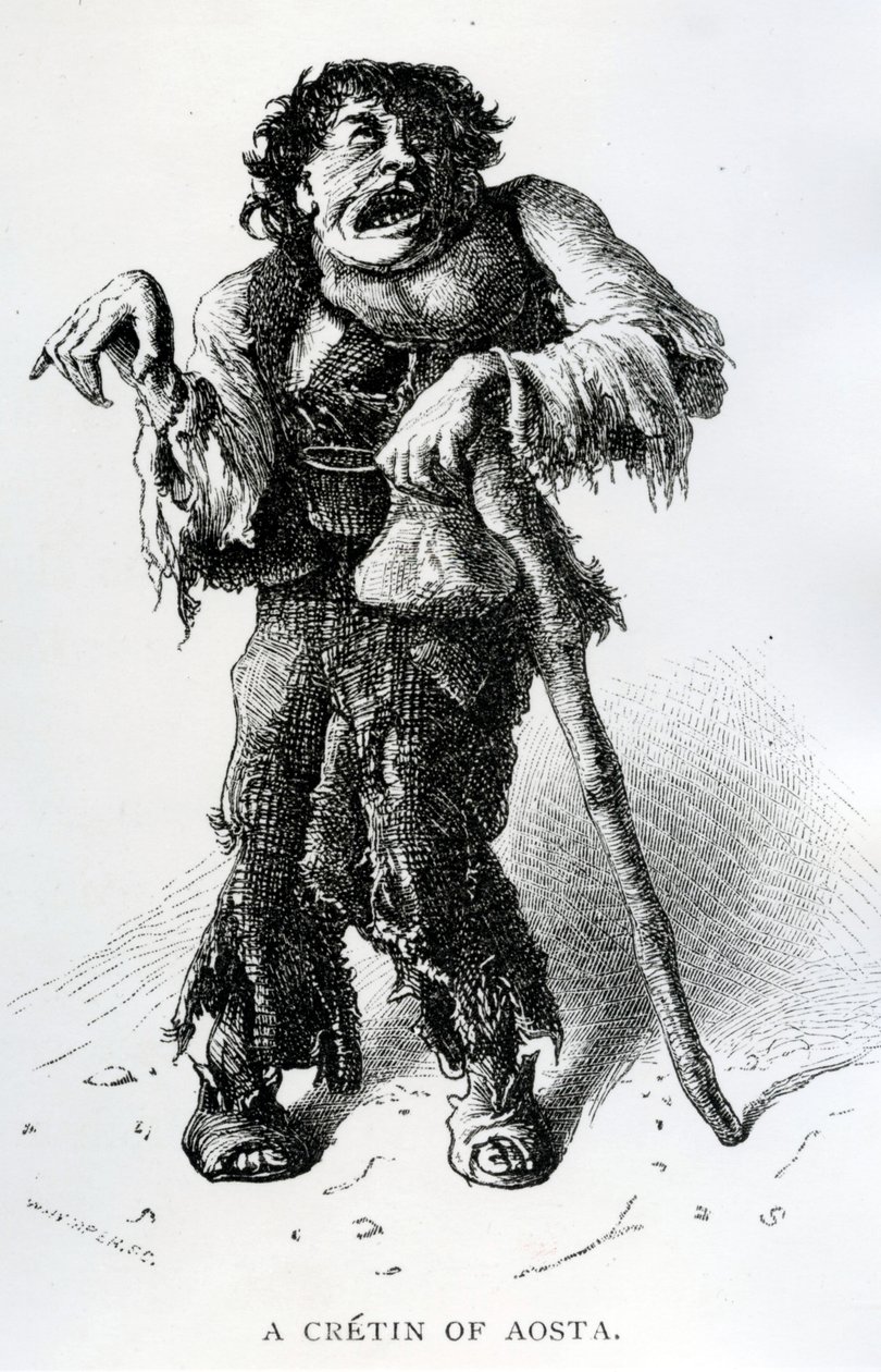 Ein Kretin von Aosta, ca. 1870 von Edward Whymper
