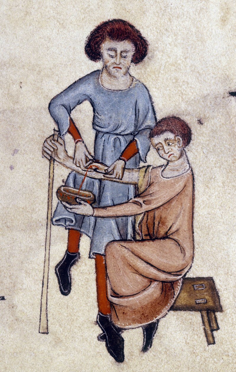 Aderlass, aus dem Luttrell-Psalter, ca. 1325-35 (Pergament) von English School