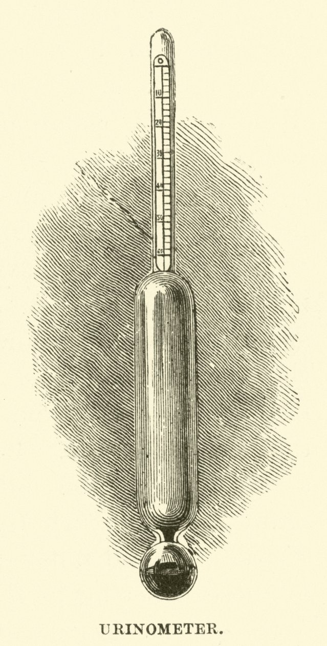 Urinometer (Gravur) von English School