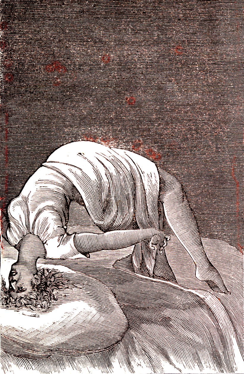 Hysterie, geistige und nervöse Störung, verursacht durch intensive Angst. 1887 von French School