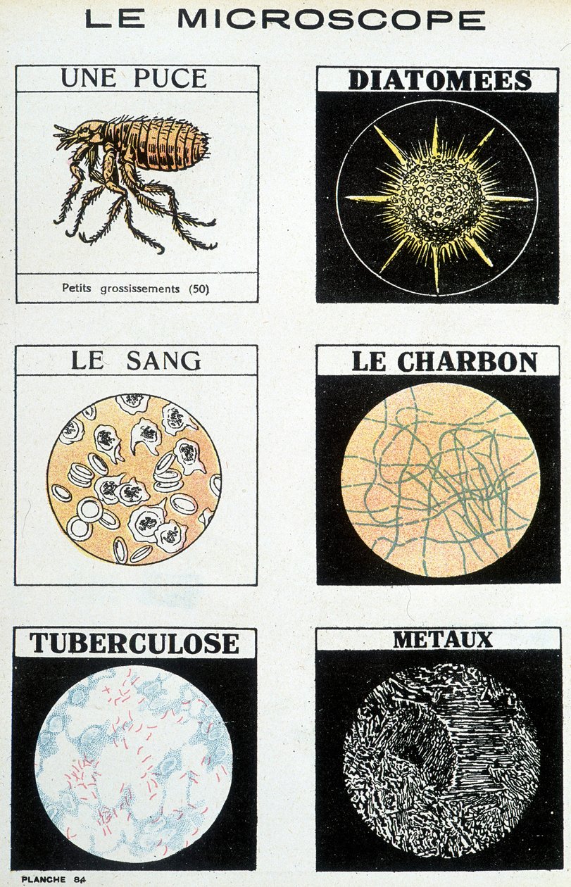 Mikroskope: ein Floh, Diatomeen, Blut, Kohle, Tuberkulose, Metalle von French School