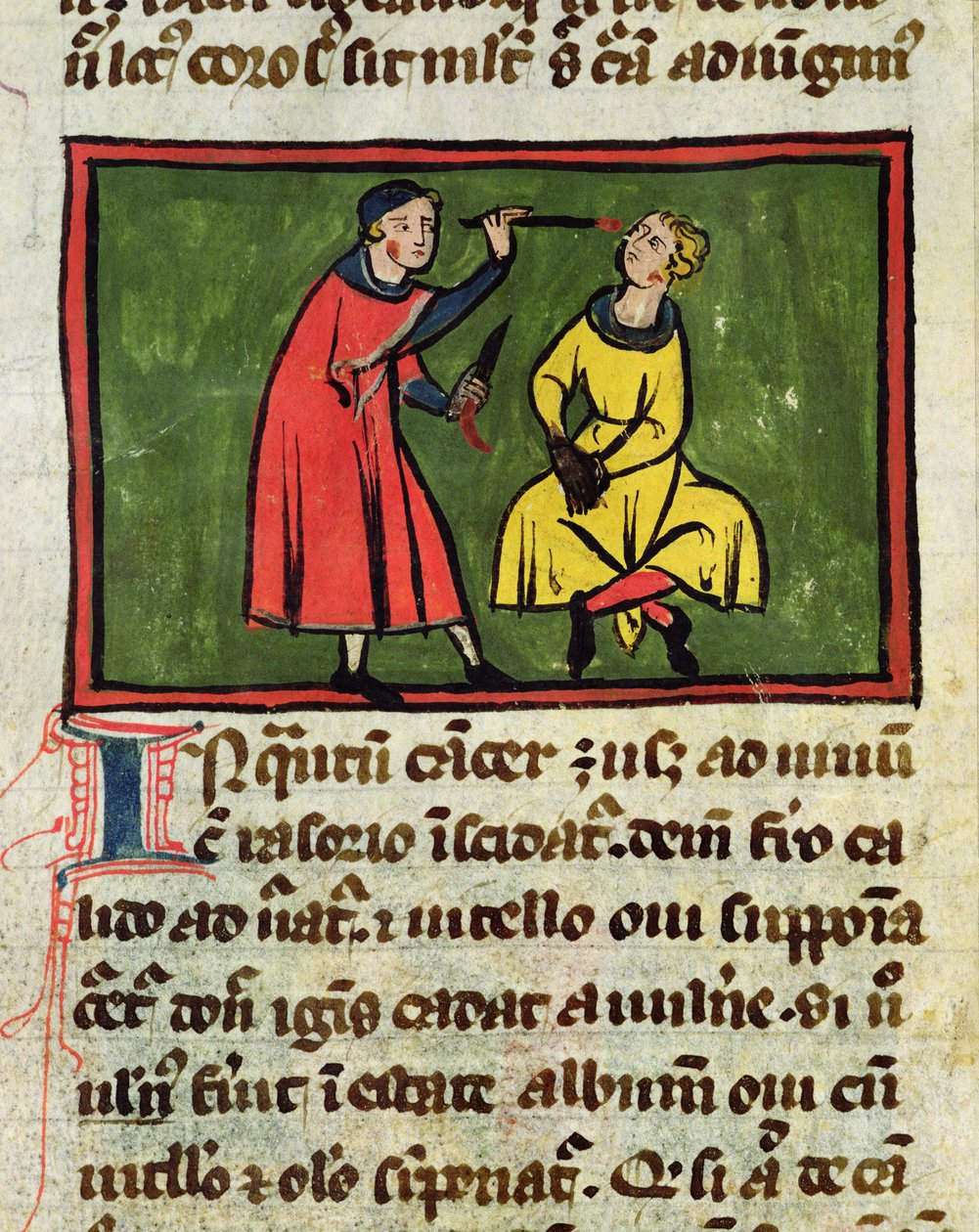 Chirurgische Behandlung, aus einer Ausgabe des Buches der Chirurgie von Rogier de Salerne von French School