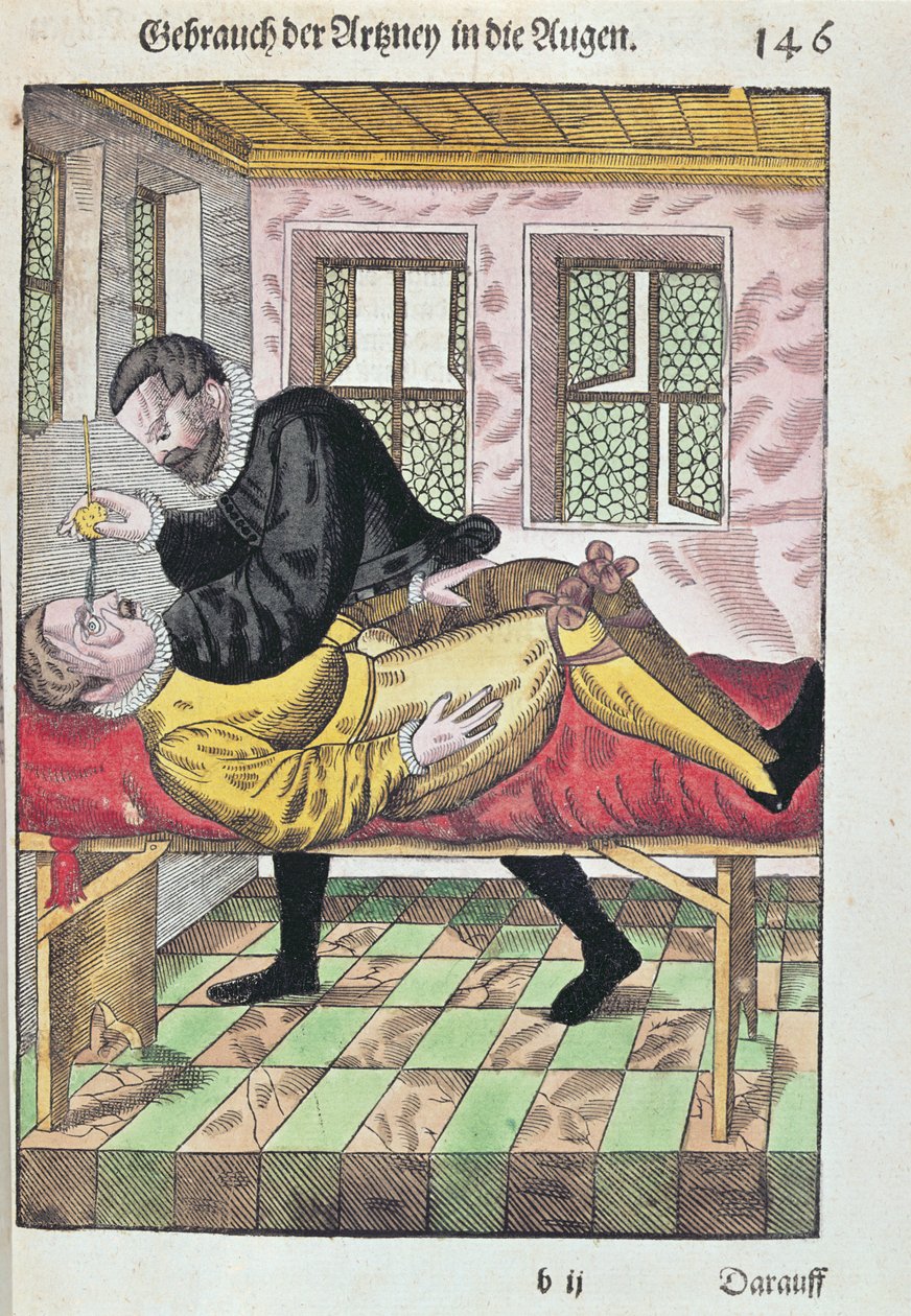 Augenoperation, aus Ophthalmodouleia von Georg Bartisch, veröffentlicht in Dresden 1583 von German School