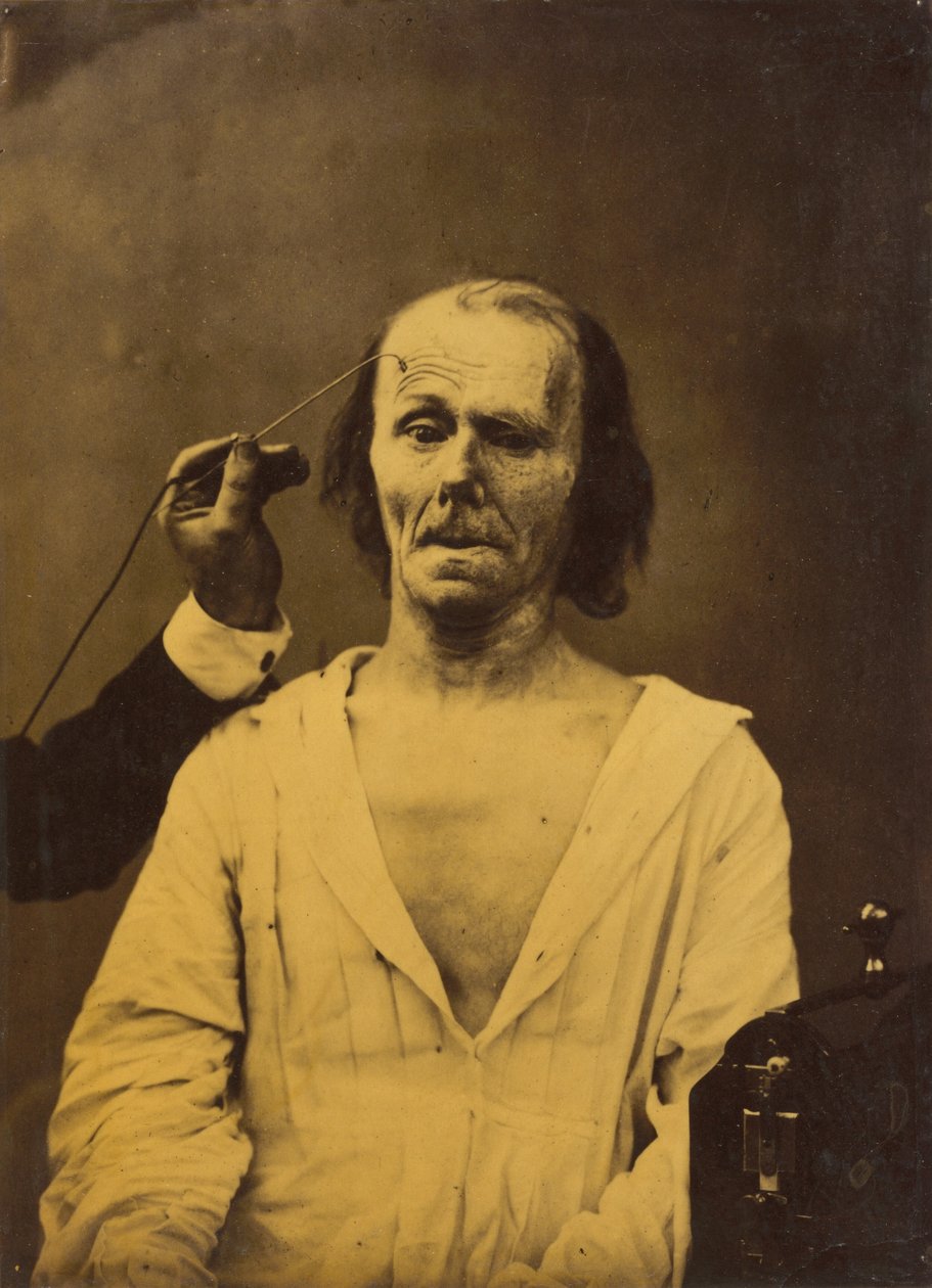 Ein entspanntes Gesicht (links); Tiefe Aufmerksamkeit (rechts), 1854-1856, gedruckt 1862 von Guillaume Benjamin Armand Duchenne de Boulogne
