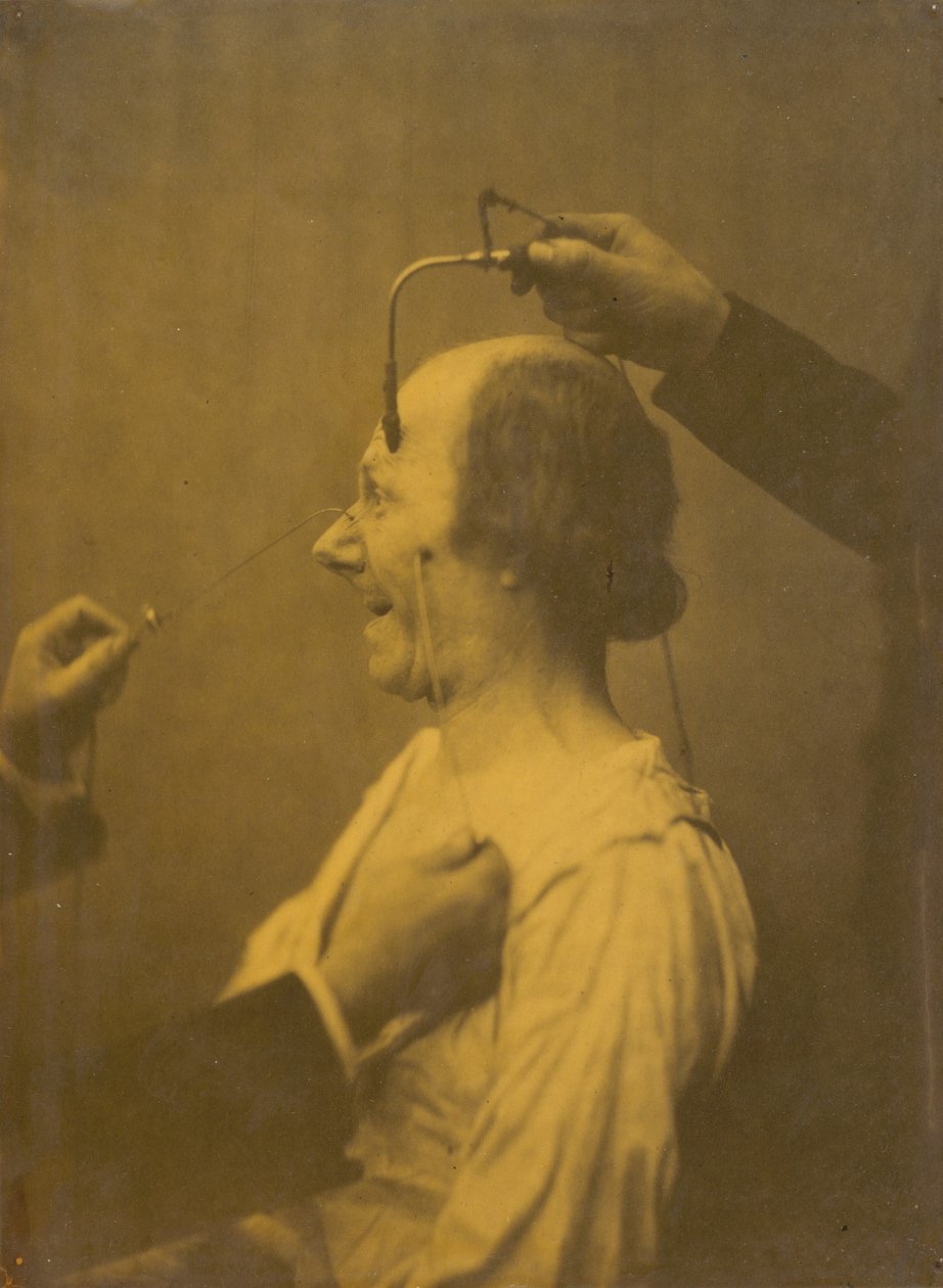 Die Aufmerksamkeit wird von einem Objekt angezogen, das laszive Ideen und Wünsche hervorruft, 1854-1856, gedruckt 1862 (Foto) von Guillaume Benjamin Armand Duchenne de Boulogne