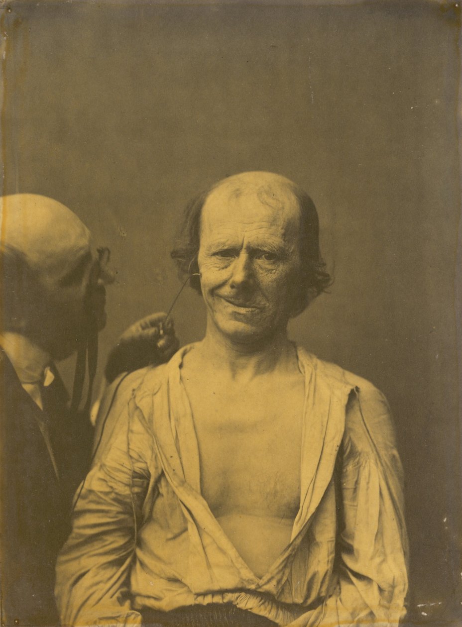 Ein entspanntes Gesicht (links); Falsche Freude oder Lachen (rechts) von Guillaume Benjamin Amant Duchenne