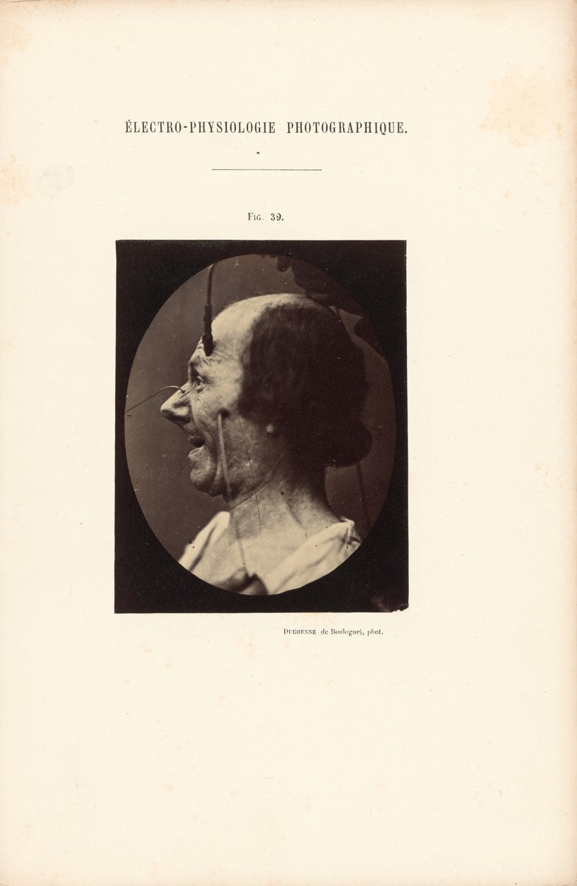 Électro-Physiologie Photographique, Abbildung 39 von Guillaume Benjamin Duchenne
