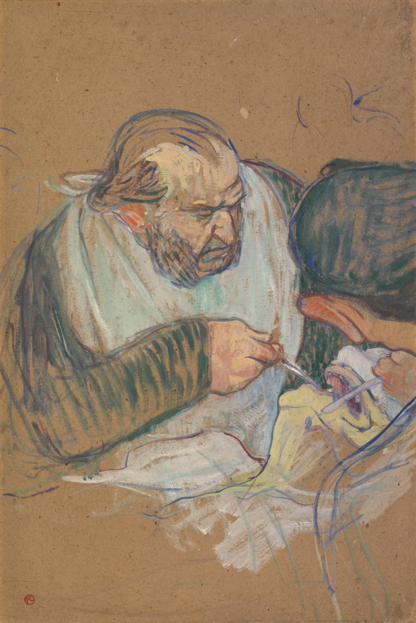 Dr. Péan bei einer Operation von Henri de Toulouse-Lautrec