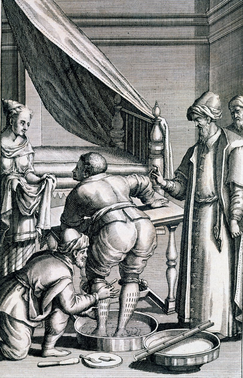 Aderlass in den Beinen, aus Medicina Aegyptiorum von Prospero Alpini, veröffentlicht 1745 von Italian School