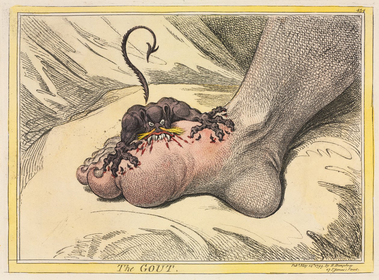 Die Gicht, 1799 von James Gillray