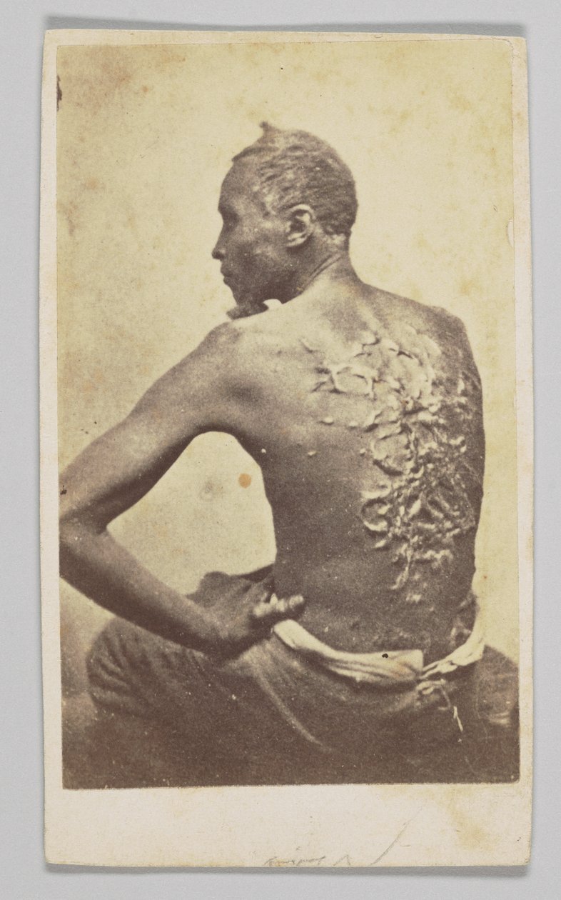 Gordon bei der medizinischen Untersuchung, 1863 von McPherson and Oliver