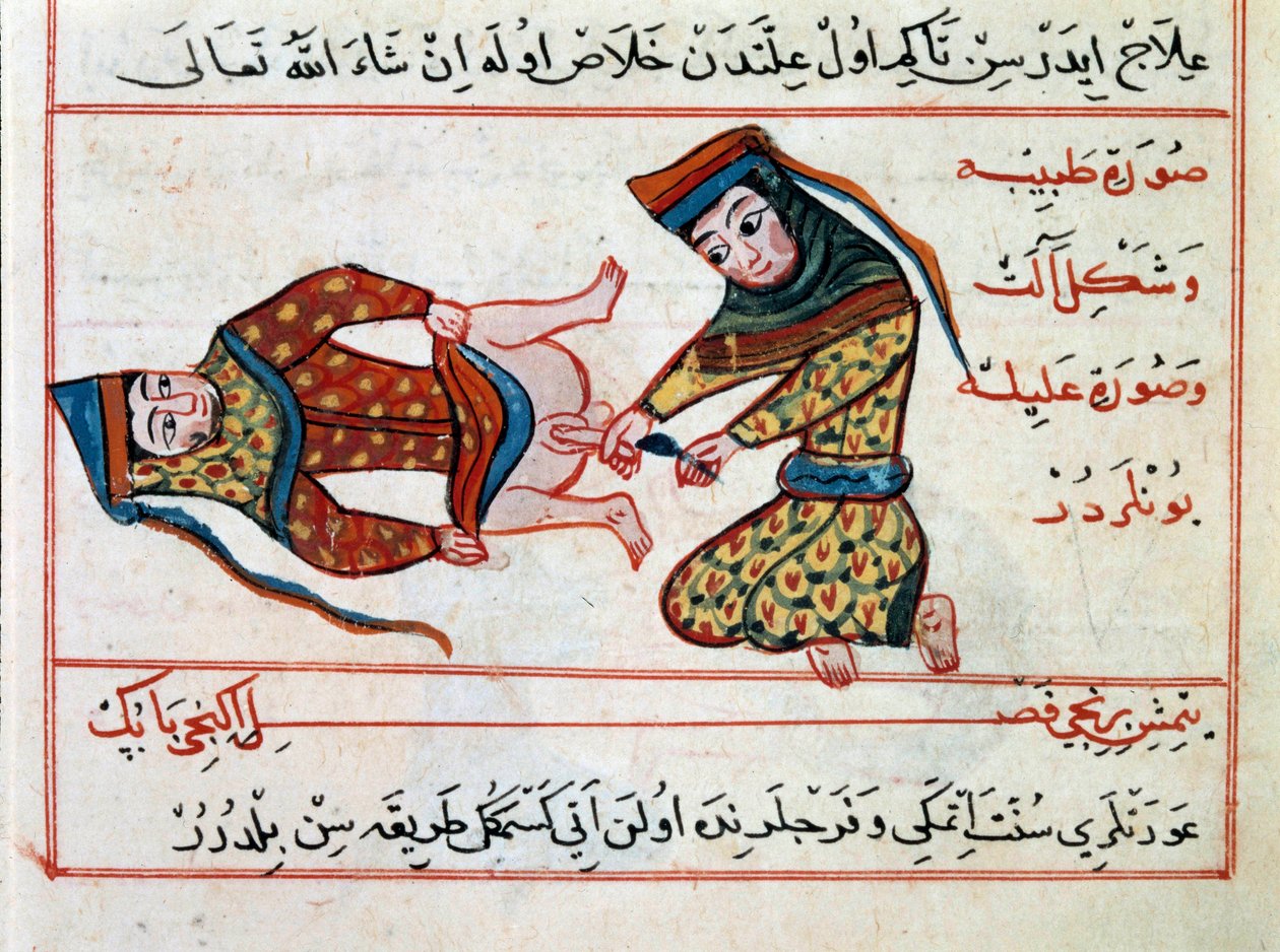 Medizin: Operation eines Hermaphroditen von Ottoman School
