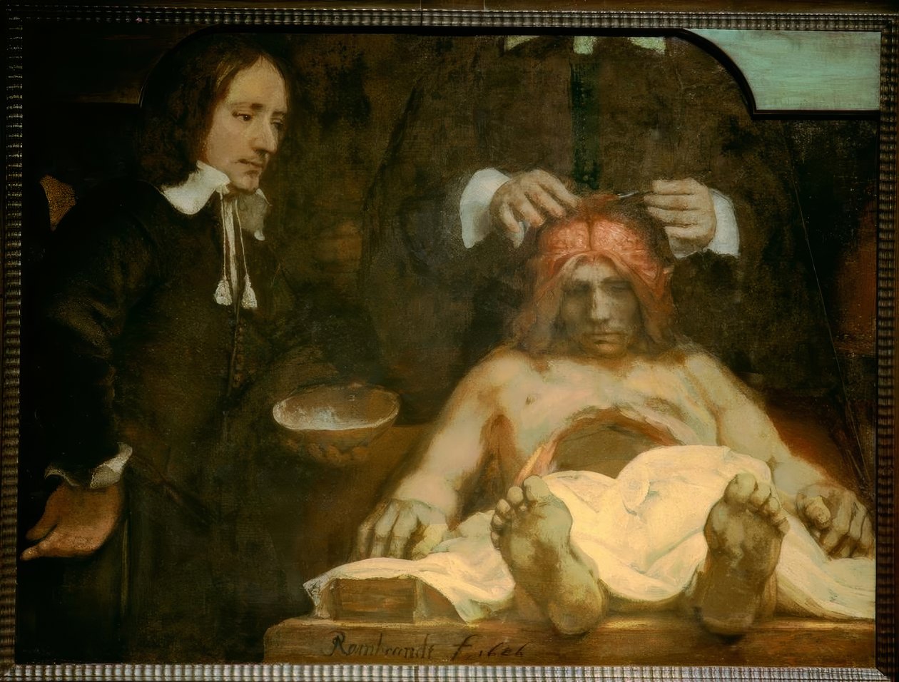 Die Anatomie des Dr. Johan Deijman von Rembrandt van Rijn