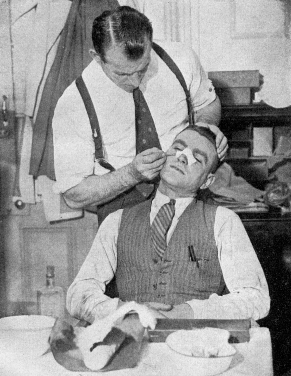 Englands Kapitän Eddie Hapgood erhält Behandlung für eine gebrochene Nase nach einem Spiel gegen Italien, 1934 von Topical Press Agency