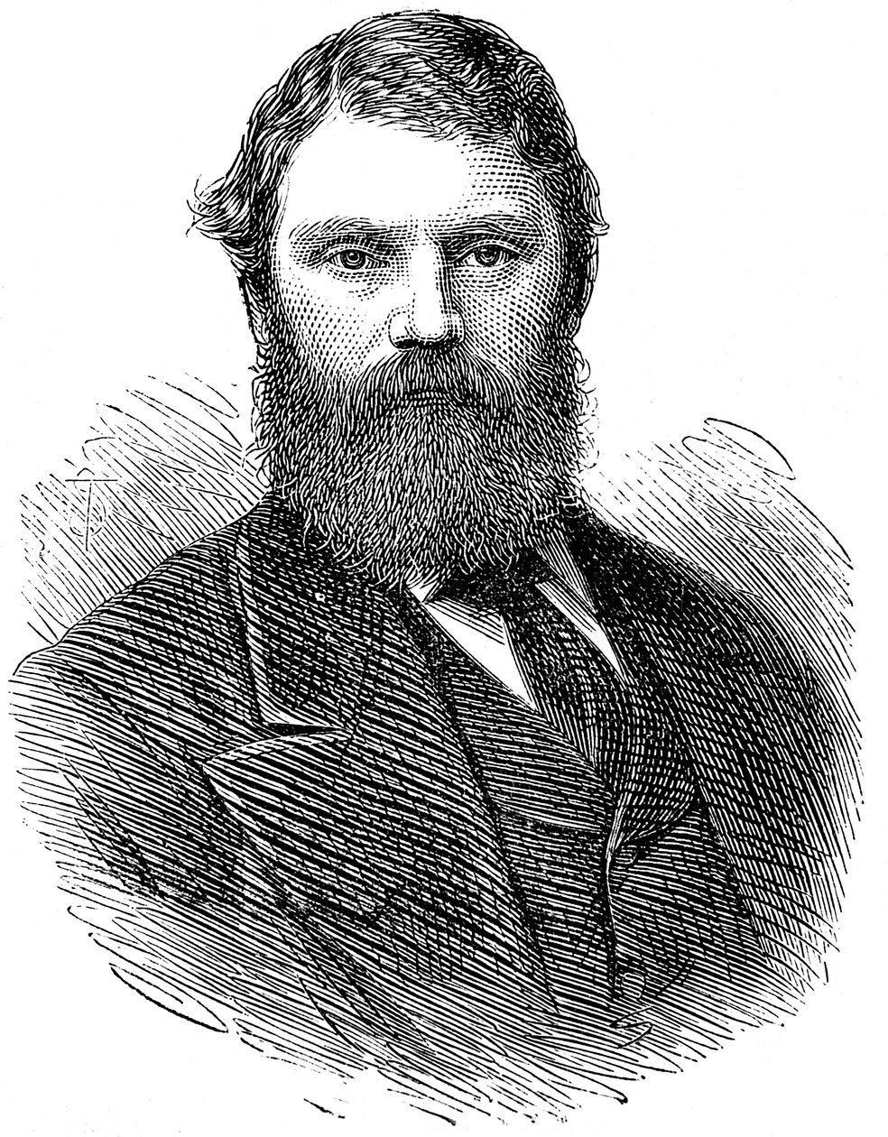 Francis Edmund Anstie 1833-1874, englischer Arzt, 1874 von Unbekannt