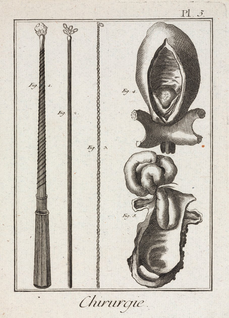 Ausrüstung, frühmoderne chirurgische Instrumente und Diagramme von Körperteilen von Unbekannt