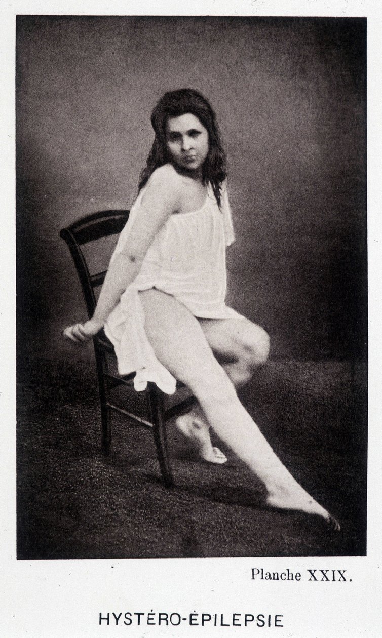 Hystero Epilepsie - Kontraktur in „Photographische Ikonographie der Salpêtrière: Dienst von Herrn Charcot“ von Paul Regnard und Bourneville von Unknown artist