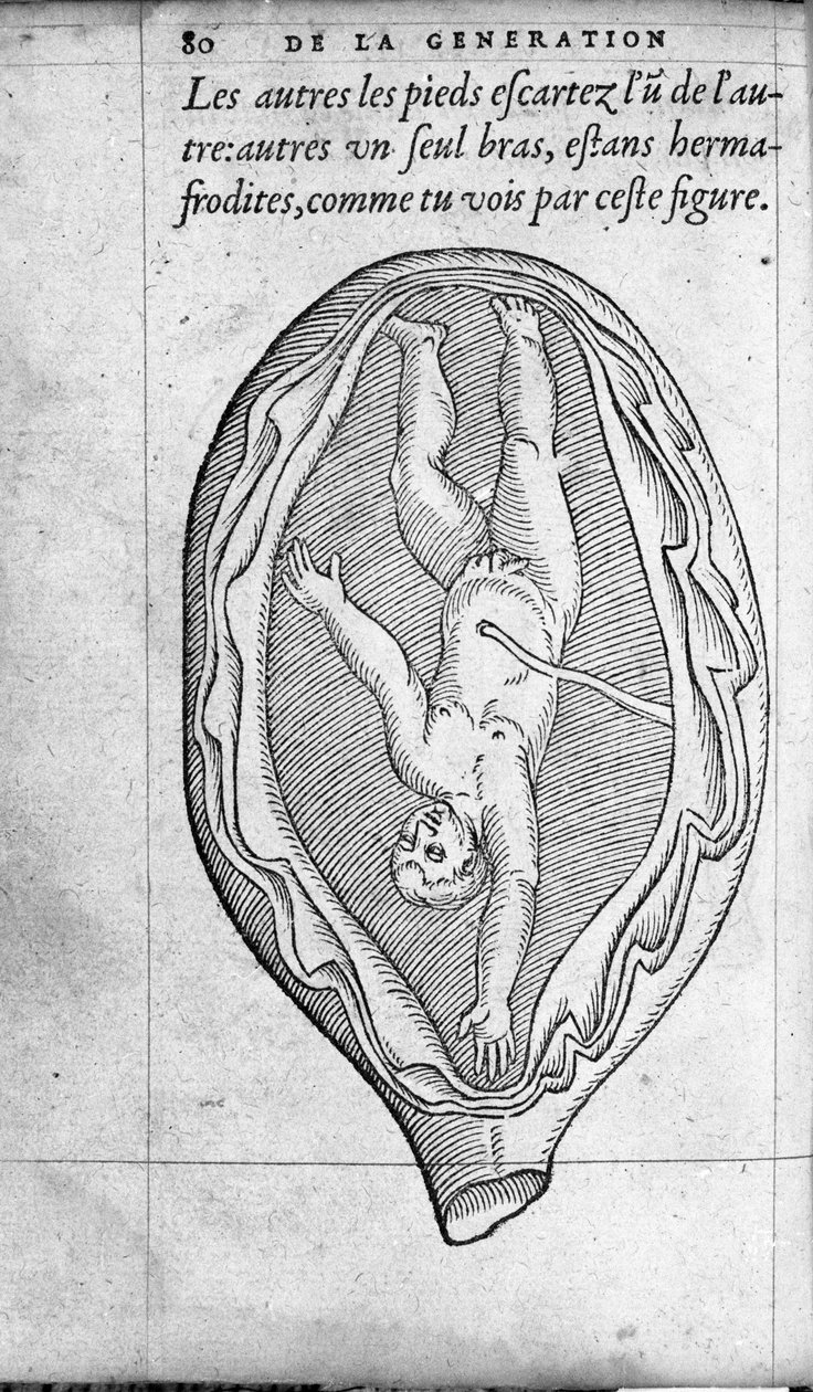 Die Position des Fötus in der Gebärmutter während der Schwangerschaft. Gravur aus „De la generation des enfants“ von Ambroise Paré (1509-1590) 16. Jahrhundert von Unknown artist