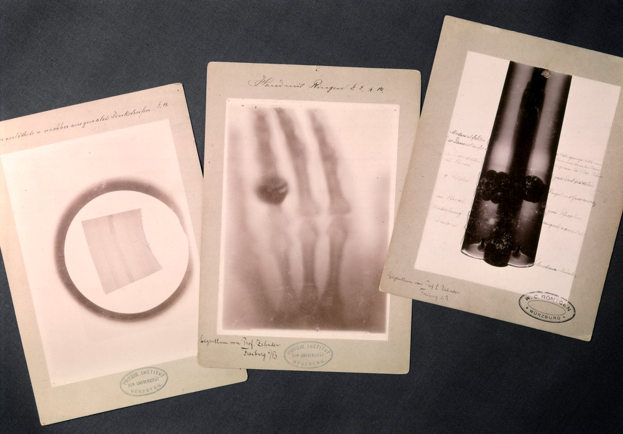 Originale Radiographien von Röntgen von Wilhelm (after) Röntgen