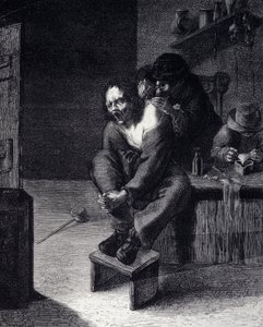 Die chirurgische Operation. Gravur nach einem Gemälde von Adrien Brauwer (gestorben 1608) 17. Jahrhundert von Adriaen (after) Brouwer