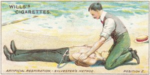 Künstliche Beatmung, Sylvesters Methode - Position 2, Nr. 17 aus der Erste-Hilfe-Serie von Willss Zigarettenkarten, 1913