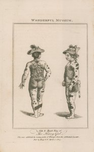 Seiten- und Rückansicht des haarigen Mädchens von English School