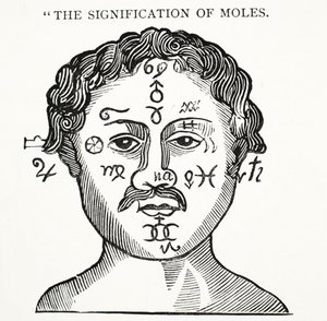 Die Bedeutung von Muttermalen, Illustration aus Chap-books of the Eighteenth Century von John Ashton, veröffentlicht 1882