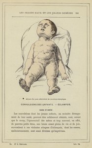 Haltung eines kleinen Kindes mit eklamptischen Krämpfen