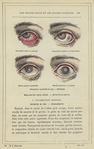 Oberflächliche Augenentzündungen, Ophthalmien