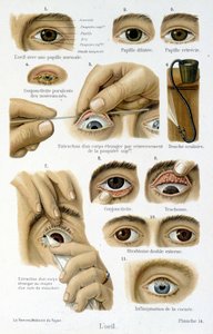 Medizin: das Auge