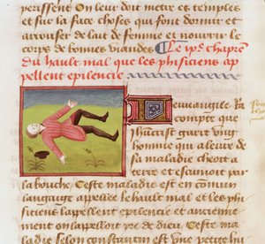 Patient, der an einem epileptischen Anfall leidet, aus Le Livre des Propriétés des choses von Barthélemy l