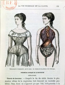 Die schädlichen Auswirkungen des Korsetts, Illustration aus La Vie Normale et la Santé von Dr. Jules Rengade (geb. 1841) ca. 1880