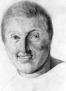 Ein Epileptiker - in „Etude de la physiognomy des aliénés“, Zeichnung von Gabriel