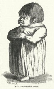 Kretin, Frau mit angeborenem Jodmangelsyndrom (Gravur) von German School