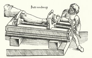 Vorrichtung zum Richten eines verletzten Beins von German School