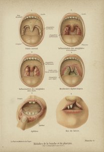 Krankheiten und Störungen des Mundes und des Rachens