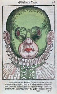 Maske zur Behandlung eines Strabismus, aus Ophthalmodouleia von Georg Bartisch (1535-1636) veröffentlicht in Dresden 1583 (Farbholzschnitt) von German School