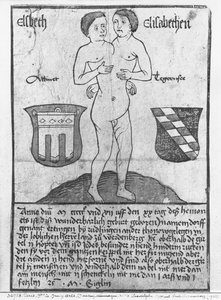 Siamesische Mädchen, Elsbeth und Elisabethen