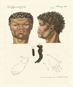 Der Hottentotte oder Buschmann (Farbstich)