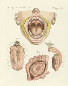 Der Geschmack (Farbstich)