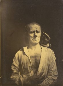 Krampf des M. corrugator supercilii unter sehr starkem Licht (links); Ein entspanntes Gesicht (fotografiert im vollen Sonnenlicht) (rechts), 1854-1855, gedruckt 1862 (Foto)
