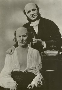 Französischer Neurologe Duchenne de Boulogne benutzt sein Elektrophysiologie-Apparat an einem alten Mann