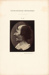 Électro-Physiologie Photographique, Abbildung 39 von Guillaume Benjamin Duchenne