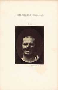 Elektro-Physiologie Fotografisch, Figur 53