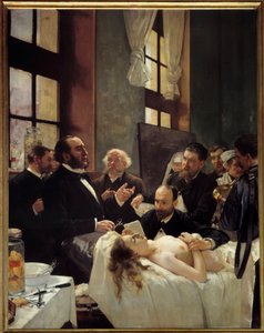 Dr. Jules Emile Pean lehrt im Krankenhaus Saint Louis seine Entdeckung des Kneifens von Schiffen vor der Operation