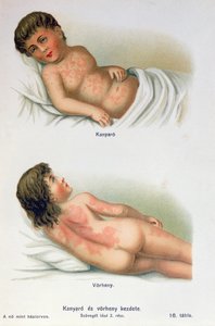 Masern und Scharlach, aus einem Familienmedizinbuch, ca. 1900